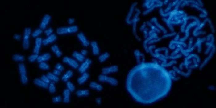 Генетики пояснили, почему от коронавируса чаще умирают мужчины