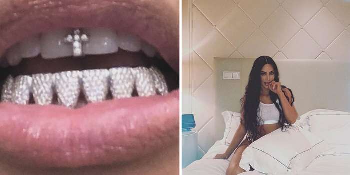 Американська знаменитість показала діамантові зуби