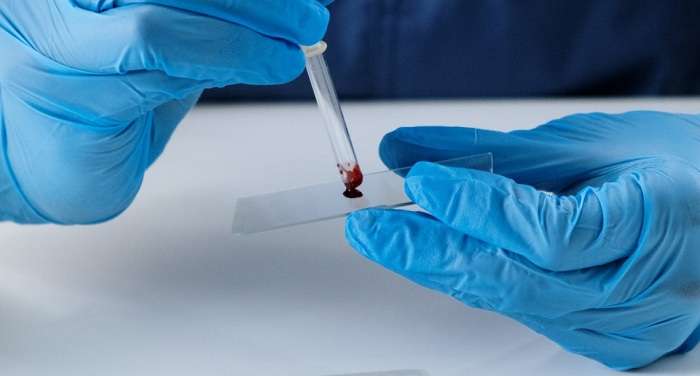 «Слуги народу» запропонували створити базу ДНК українців