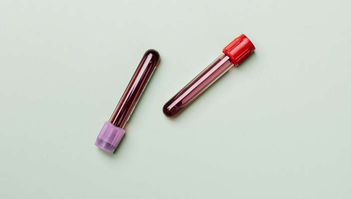 Группа крови и COVID-19 – Кому повезло больше