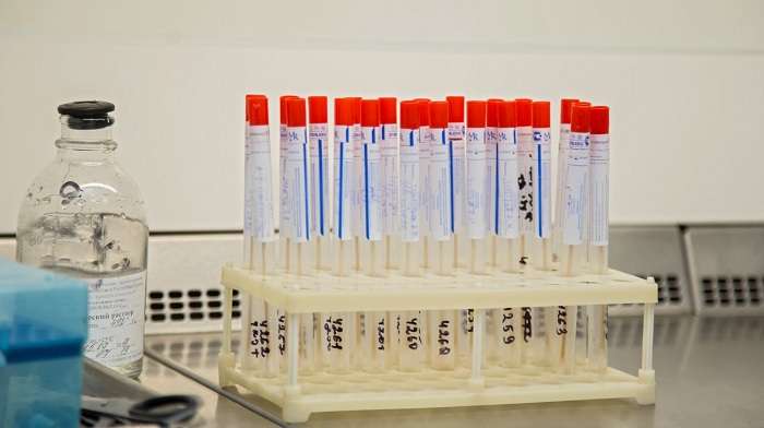 В Крыму коронавирусом заразилась украинка – Аксенов