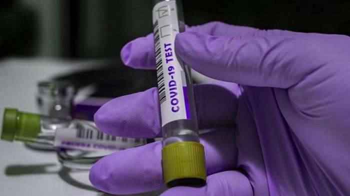 У світі понад 18 мільйонів хворих на коронавірус