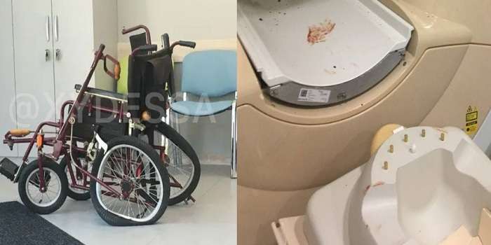 В Одесі апарат МРТ «засмоктав» чоловіка з інвалідною коляскою