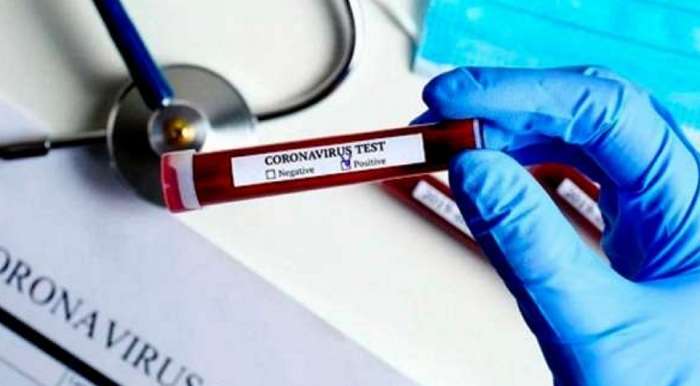 Нові дані МОЗ – В Україні плюс 504 людини з COVID-19