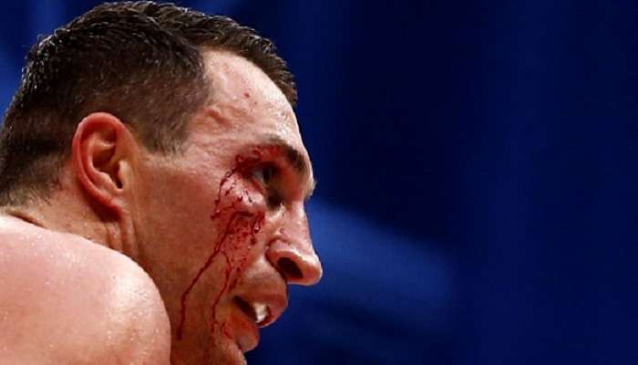 Виталий Кличко поддержал решение брата Владимира об уходе из бокса