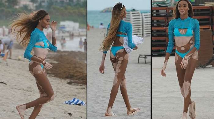 В Сети появились новые фото известной пятнистой модели