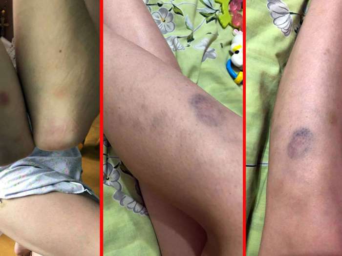 Доцент РГГУ побила роженицу, а теперь «прикрывается» влиятельным мужем-янтарщиком