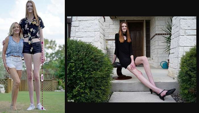 Появилась новая обладательница самых длинных ног в мире