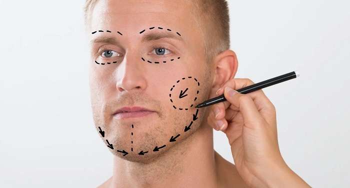 В Украине к пластике лица чаще прибегают мужчины-политики – хирург