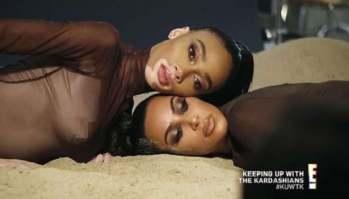 Ким Кардашян сделала фото с известной пятнистой моделью